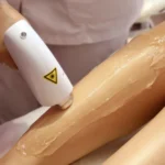 skin treatment process for a women in kokapet