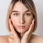 before and after of a treatment in kokapet