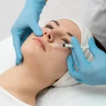 Filler treatment for women in kokapet