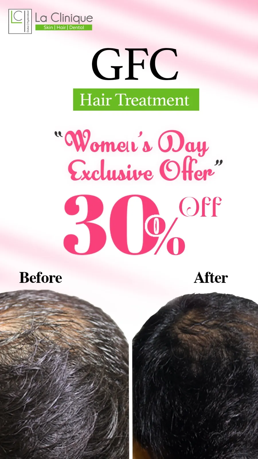 Womens day skin treatment offer in Kokapet