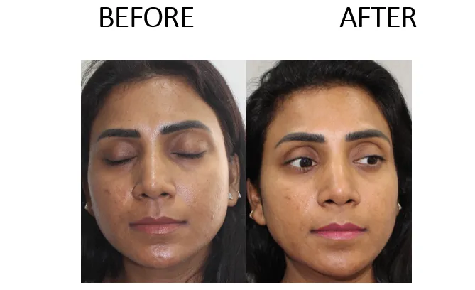 IV-Glutathion-Drips-for-Skin-Lightening-10-sessions.png