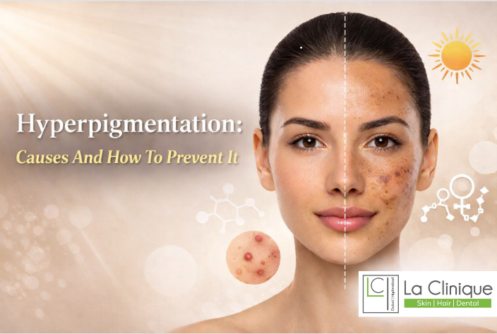 how to prevent hyperpigmentation