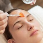 Chemical peels