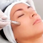 Exosomes Treatment