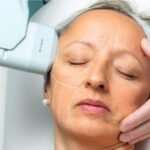 Loss of skin firmness